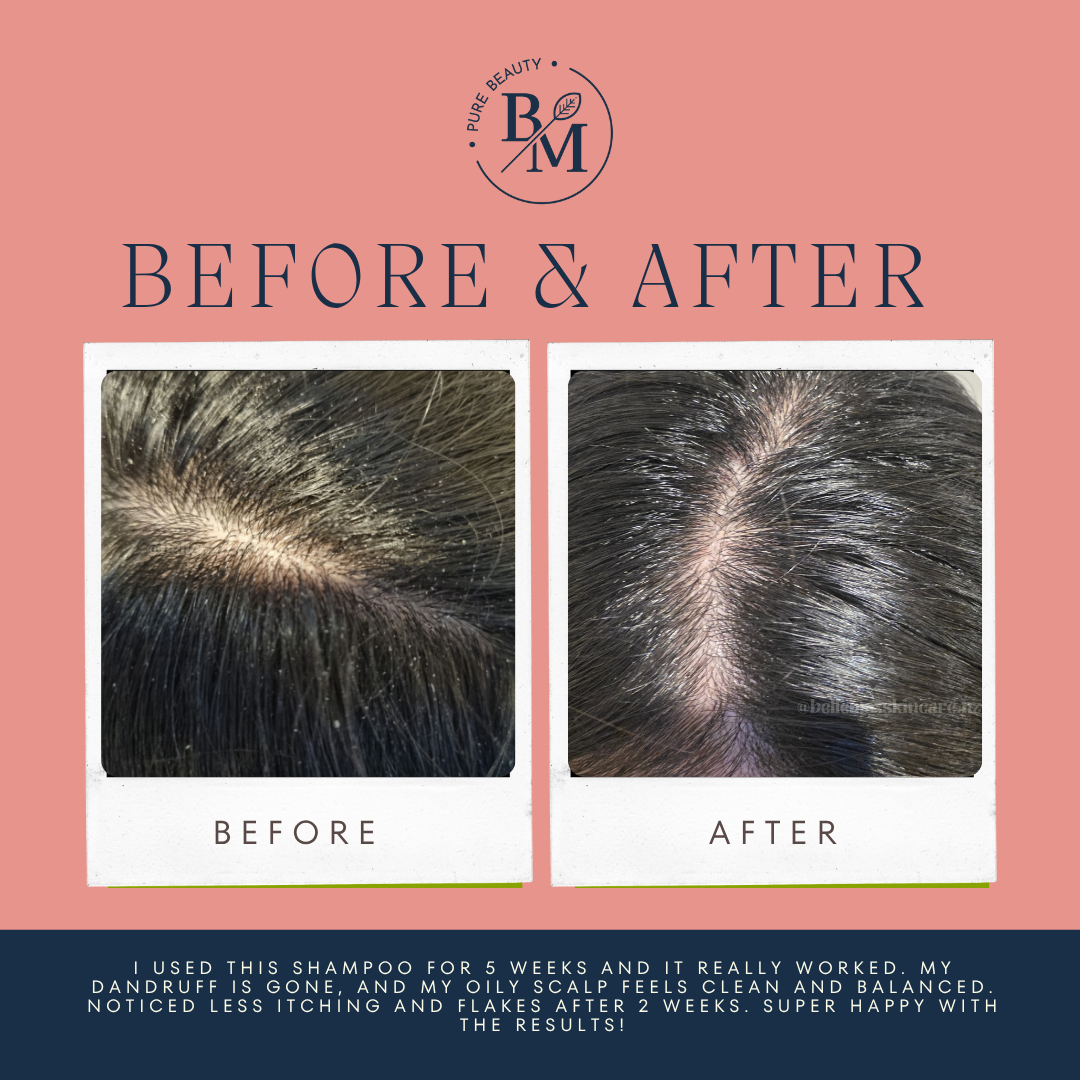 BelleMax Rosemary &Aloe Vera Revitalising Shampoo