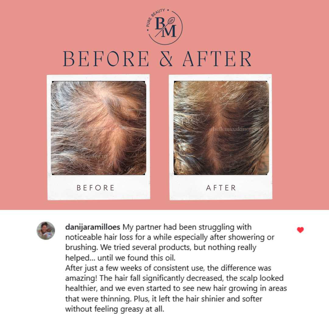 Hair & Scalp oil